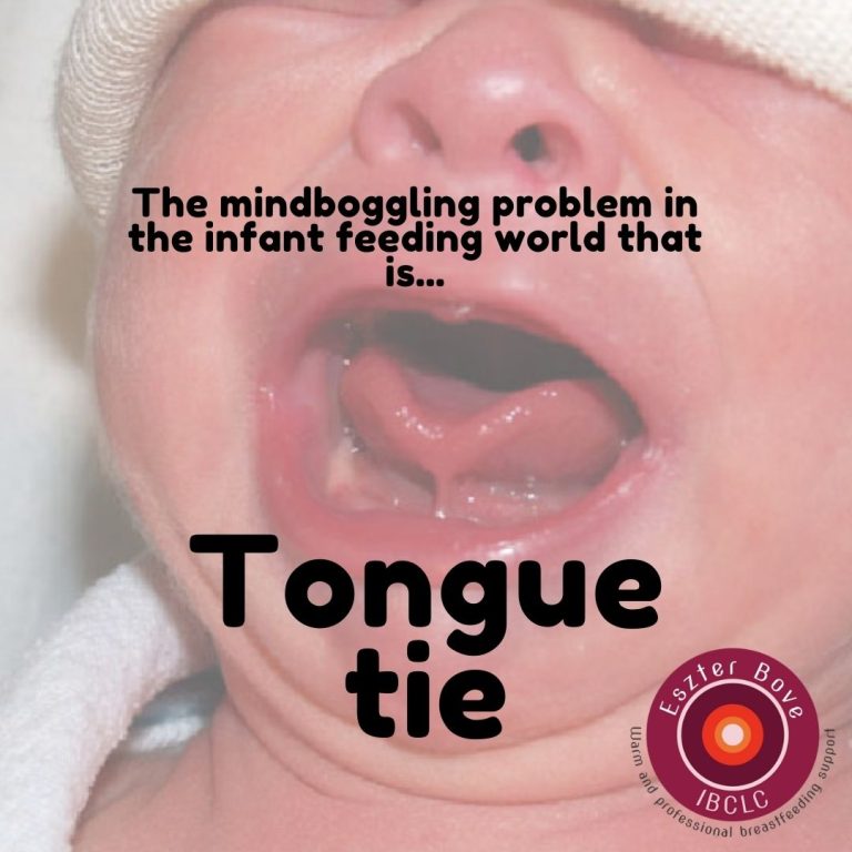 The mindboggling issue… Tongue tie